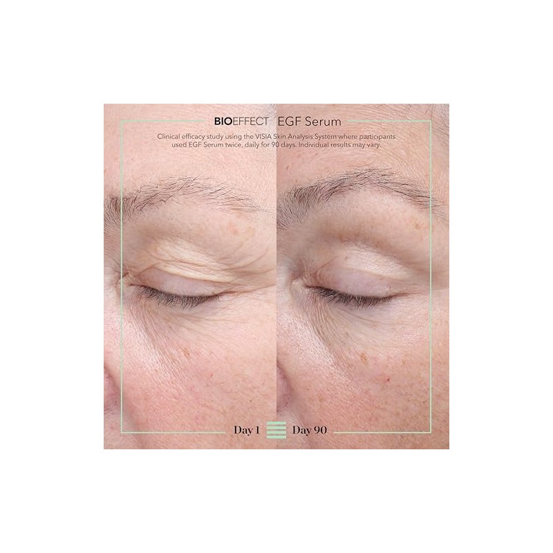 Isispharma Glyco-a Soft Peeling 30ml