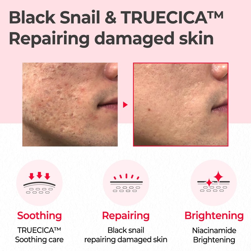 SOME BY MI Snail Truecica Miracle Repair Toner (135ml, 4.56oz)