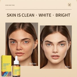 Discoloration Correcting Serum,Skin Brightening Serum with Niacinamide,Dark Spot Correcting Skin Care,Skin Lighting Serum for Face to Even Skin Tone Minimize Pores and Repair Sun Marks,for All Skin