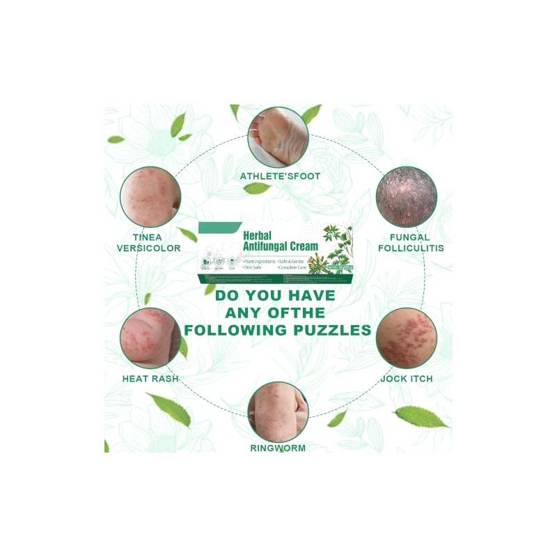 Herbal Antifungal Cream