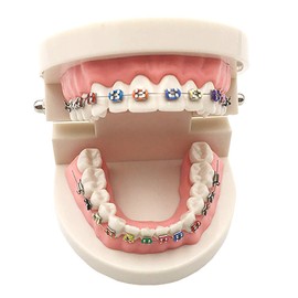 Island chief Dental Model Dental Model Teaching Teaching Orthodontics Human Body Model Life Size Dental (For Orthodontics)