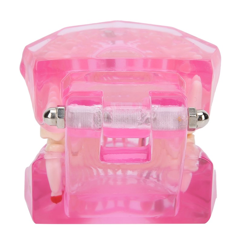 Transparent Adult Teeth Model Pathological Repair Studying Dental Teaching Tools