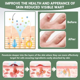 NatureErase Skin Blemish Appearance Corrector Gel, Dark Spot Minimizing Cream, DermaEase Tone-Enhancing Formula for Body Care, Reduces Dullness & Evens Complexion, Gentle Formula for All Skin Types