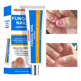 Para Uñas De Manos Y Pies-crema Para Hongos En Las Uñas Ndc