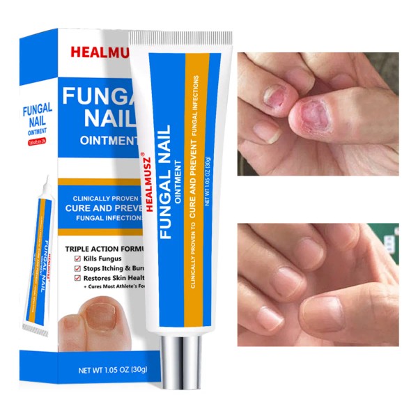 Para Uñas De Manos Y Pies-crema Para Hongos En Las