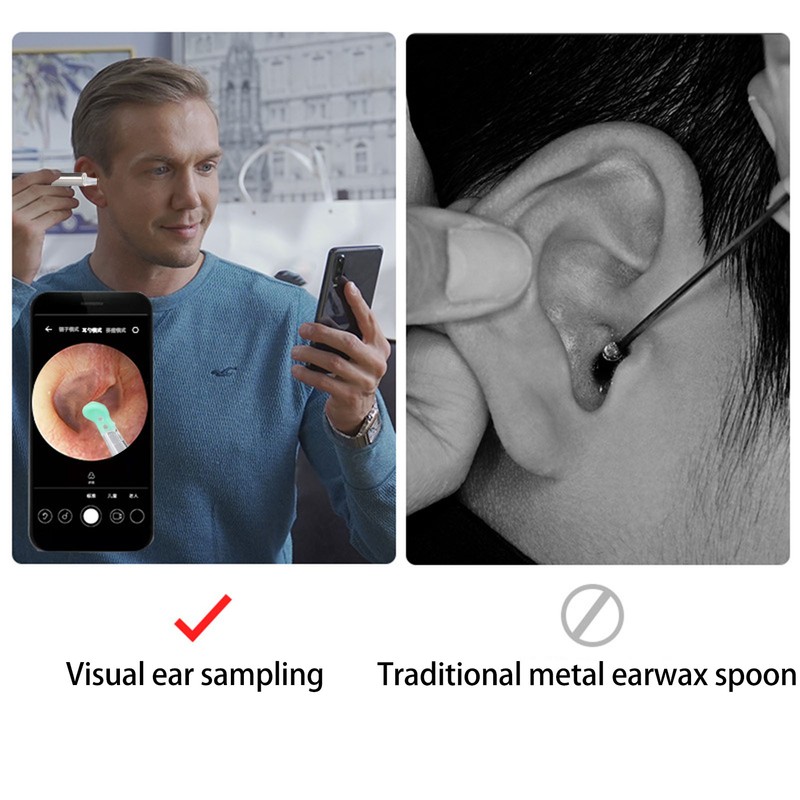 Ear Wax Removal Tool LED Light 1080P Ear Scope Camera