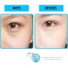60 Parches Ácido Hialurónico Contorno Ojos Y Par 24k Ojeras