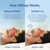 Difiney Advanced Anti Snoring Device 4.0 Clear: Adjustable Custom-Fit Anti