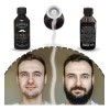 Tratamiento Bergamota Crecimiento Barba Cabello Barber Shot
