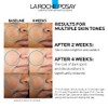 La Roche-Posay Mela-D Pigment Control Serum, 1.01 Fl. Oz.