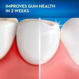 Oral-B Oral-B Gum Care Sensitive Toothbrushes, Extra Soft, 2 Count