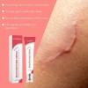 Creme De Cuidado Da Pele Laniska Para Um Corpo Macio