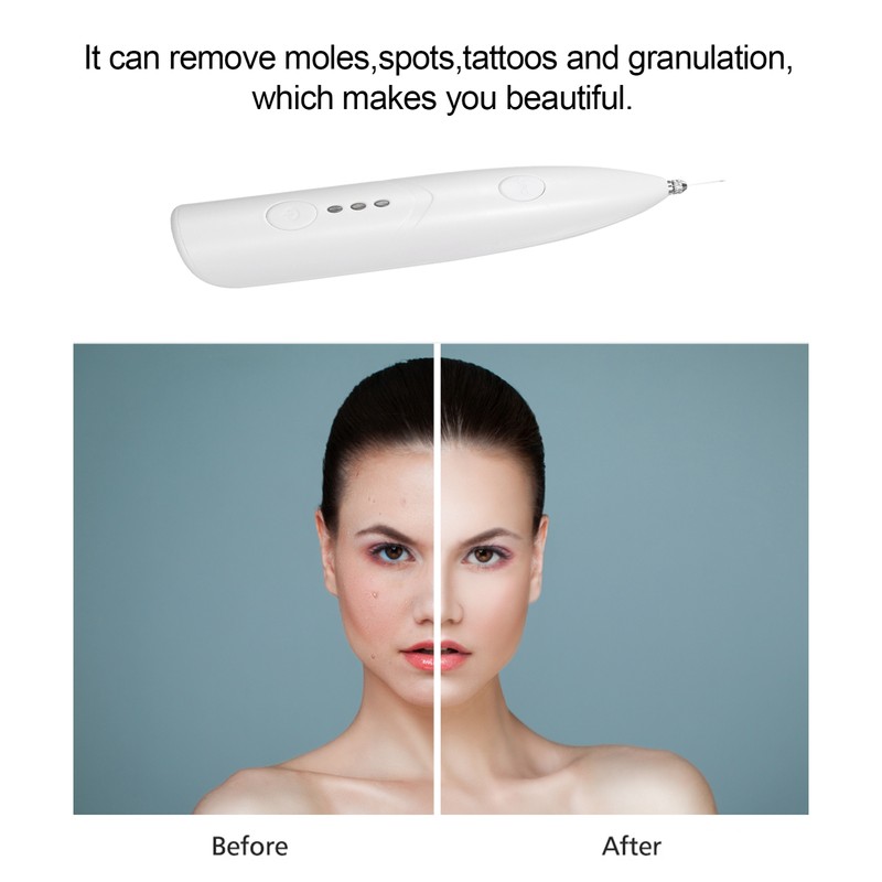 Mini Freckle Pen 3 Modes Switchable Lightweight USB Power Beauty