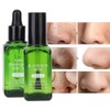 Face Nose Pores Shrinking Repairing Smoothing Blackhead Removal Liquid Essential