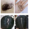 Alken System Solution SS Hair Loss Scalp Shampoo 3.1 (100%