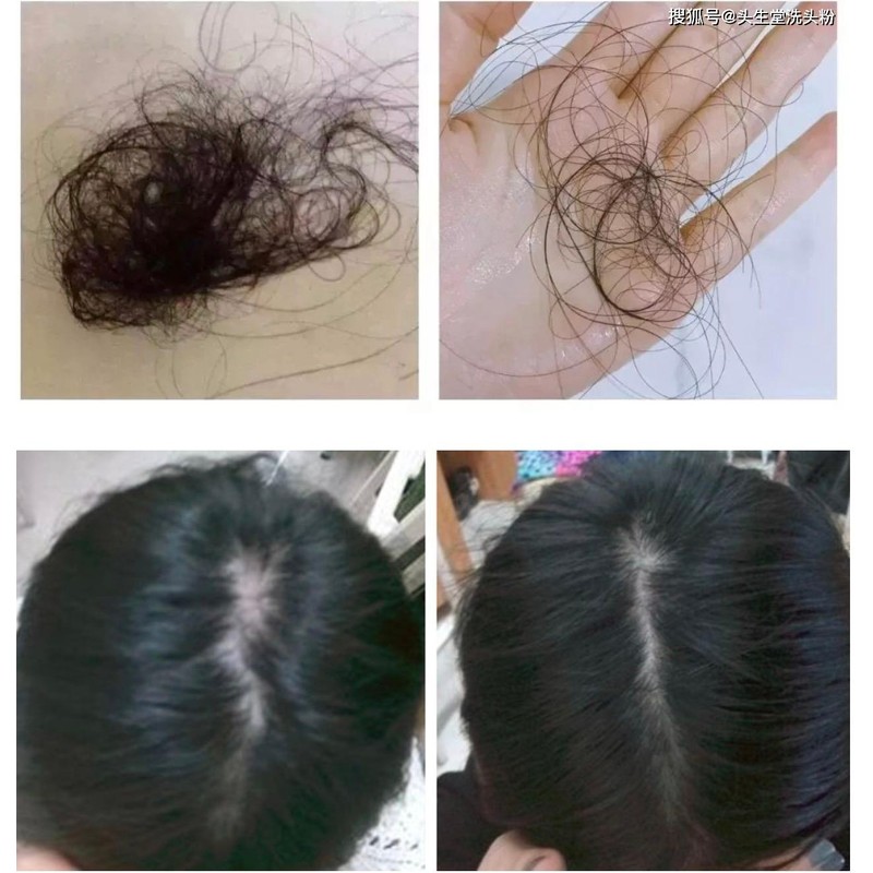Alken System Solution SS Hair Loss Scalp Shampoo 3.1 (100%
