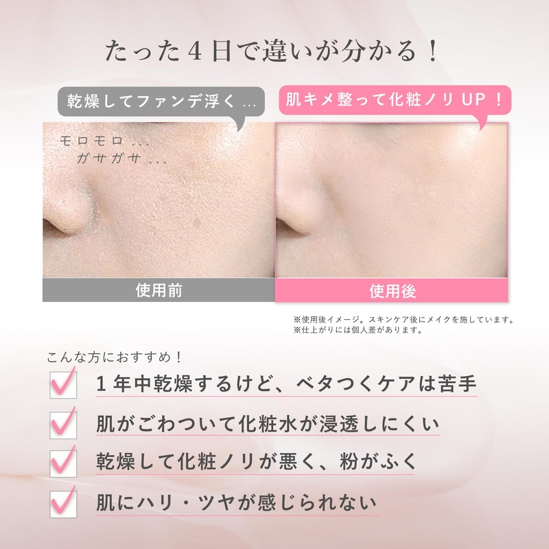 Rosemiu 1.7 fl oz (50 ml) (Liposome-introduced Beauty Serum, Improves