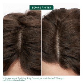 Biolage Scalp Sync Anti-Dandruff Shampoo - Controls Itchy Scalp, Deeply Cleanses Hair, Moisturizing Dandruff Treatment, With Zinc Pyrithione, Vegan & Cruelty-Free, 1.7 FL Oz