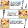 limpiador de oidos 8 piezas, Kit de eliminación de cerumen,