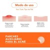 Alux Skin Parches Hidrocoloide Para Acné 30 Piezas Todo Tipo
