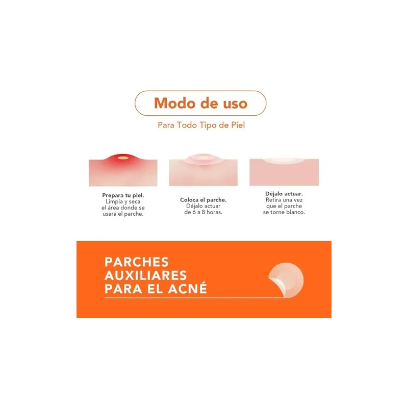 Alux Skin Parches Hidrocoloide Para Acné 30 Piezas Todo Tipo