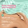 Almay Clear Complexion Acne & Blemish Spot Treatment Concealer Makeup