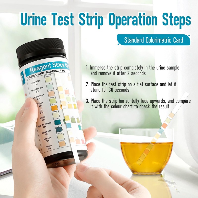 Urine Test Strips URS 10-in-1,10 Parameters UTI Test Strips,Ketone Test