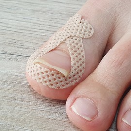 Additional pincher tape ingrown toenail corrector ingrown toenail correction band Pro Pincher Pro Band (52 pieces) / 핀처 테이프 추가 내성발톱 교정기 파고드는 발톱 교정 밴드 프로 핀처 프로밴드(52개입)