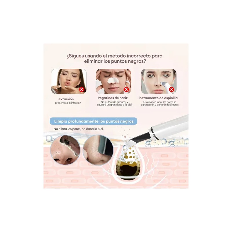 Limpiador Facial Ultrasónico Usb - Eliminación Espinillas