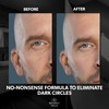 Beverly Hills Men's Dark Circle & Puffy Eye Treatment -