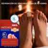 & [100 Parches Antimicóticos Para El Tratamiento De Hongos E