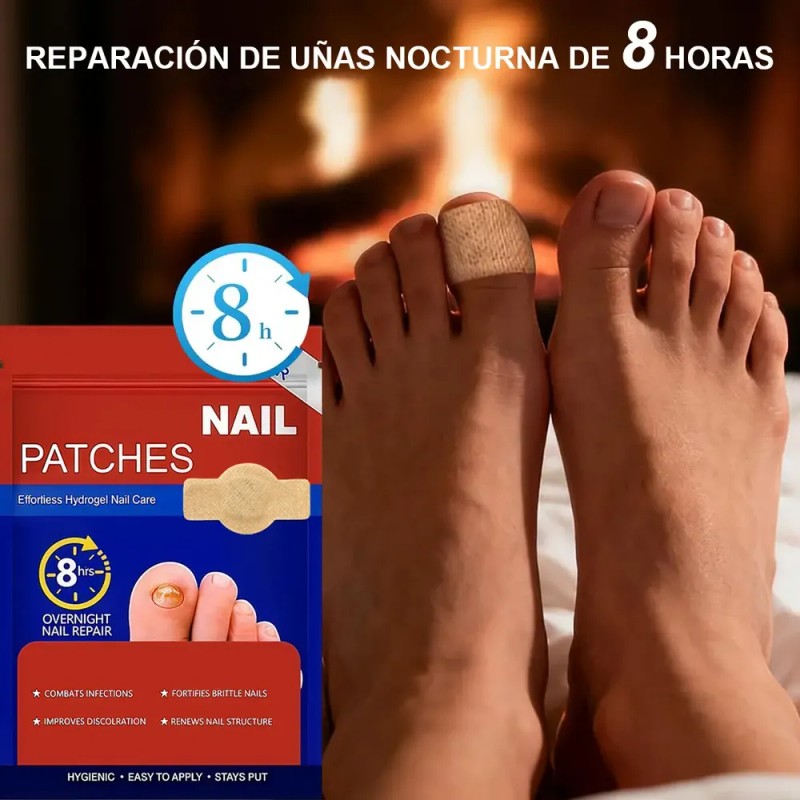 & [100 Parches Antimicóticos Para El Tratamiento De Hongos E