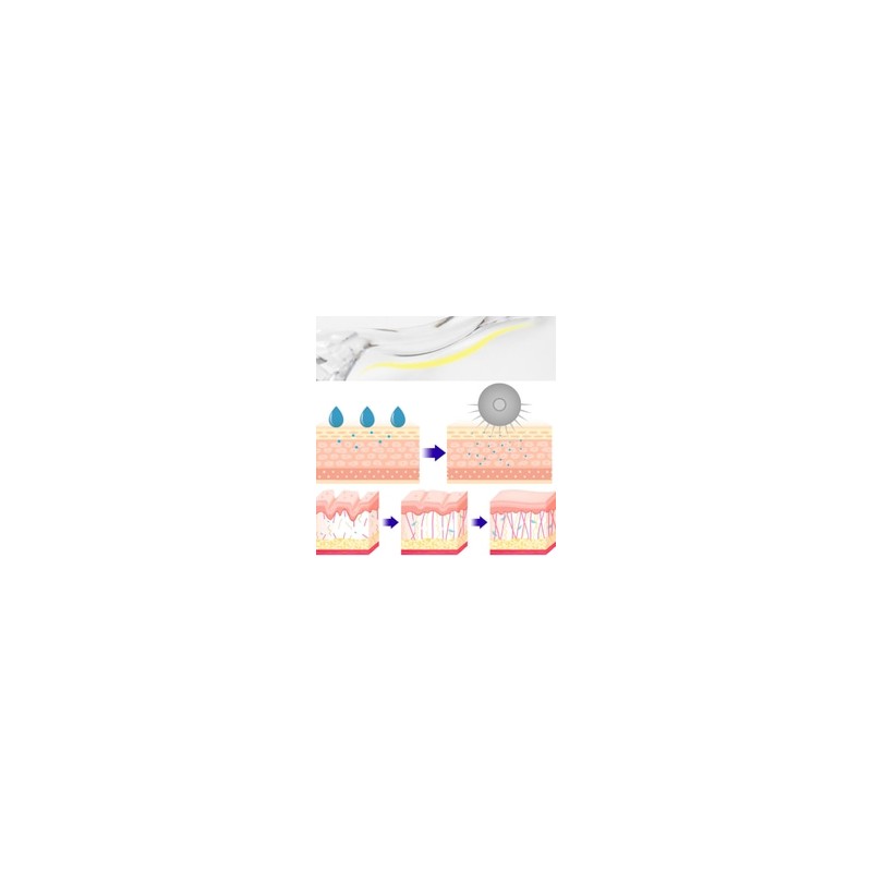 NERIAH MTS Roller 1ea, Type:0.5mm