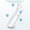 KD802 Blackhead Remover Pore Vacuum Pimple Extractor Acne Removal Kit