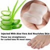 Reppkyh 16 Pieces Gel Toe Separators for Women Toe Separators