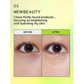 I DEW CARE Vitamin C Eye Cream with Eye Roller Set | Dark Circles Under Eye Treatment with Hyaluronic Acid, Niacinamide