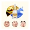 Serum Facial Vitamina C Puntos Negros Cierra Poros Aclara