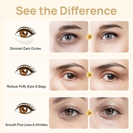 Bleuvl Bleuvl Under Eye Patches - 24K Gold Eye Mask for Puffy Eyes and Dark Circles, Wrinkles, Fine Lines, Collagen Skin Care Products, Gel Eye Patches for Dark Circles, Puffy Eyes, Undereye Bags