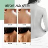 Acné De Espalda: Cura El Acné Corporal Con Ácido Salicílico
