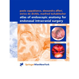 Atlas of Endoscopic Anatomy for Endonasal Intracranial Surgery