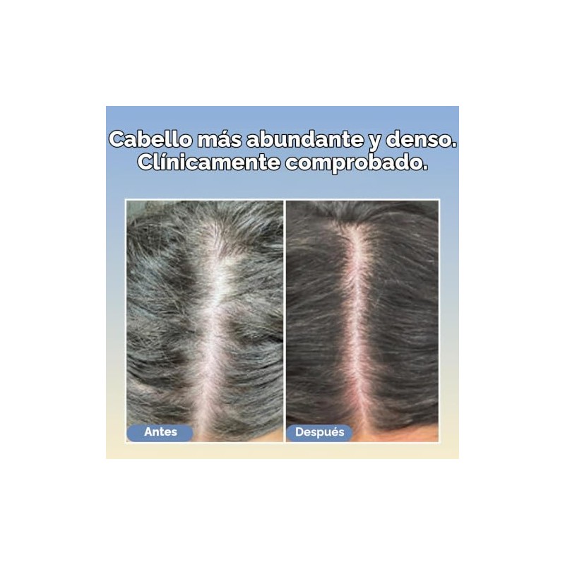 Suero para dar densidad al cabello con tripeptidos Boost Therapy.