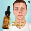 SkinLabo - Concentrated AHA+ BHA Shot Facial Serum for Blemished