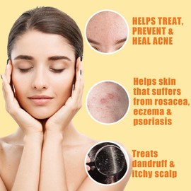 10% Sulfur Soap Cleansing Bar for Face & Body – All Natural Sulfur Facial Cleanser for Acne, Oily Skin – Skincare Blend of Lemongrass, Tea Tree Essential Oil, Vitamin E, Coconut Milk – Sulfur Soap Bar Made in USA (4 Ounce (Pack of 1)) | Erbaid