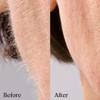 Michael Todd Beauty Sonicsmooth Pro+ Dermaplane Razor Blade Refills -