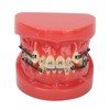 Professional Dental Demonstration Orthodontic Model with Metal Wires and Bracket