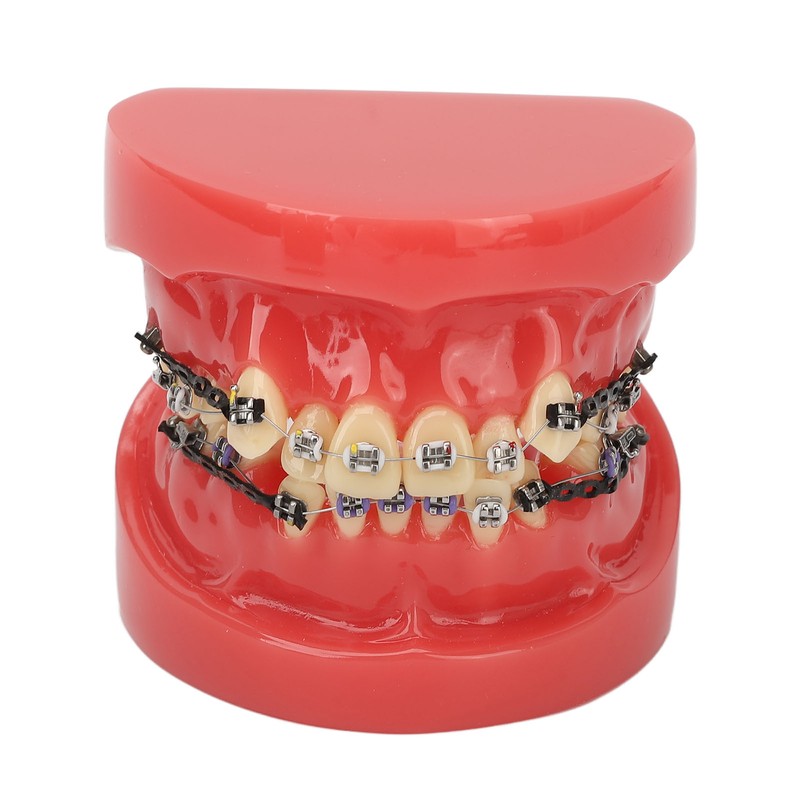 Professional Dental Demonstration Orthodontic Model with Metal Wires and Bracket