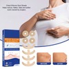 8PCS Chest Scar Patch 8PCS Nipple Patch Silicone Skin Scars