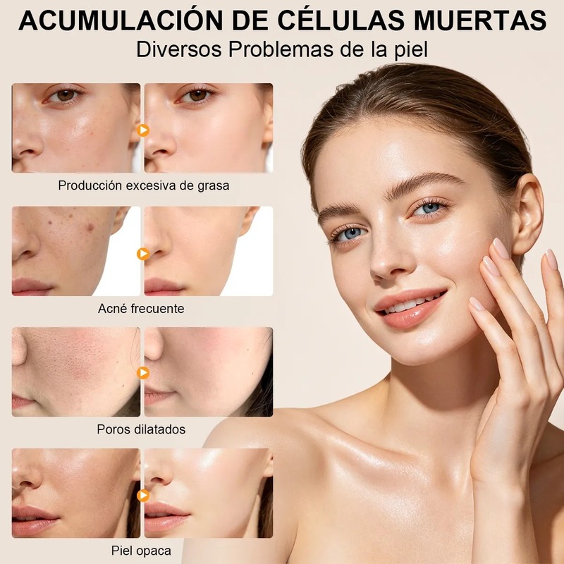 50ml2 Facial Aceite Desincrustante Exfoliante Reduce Poros