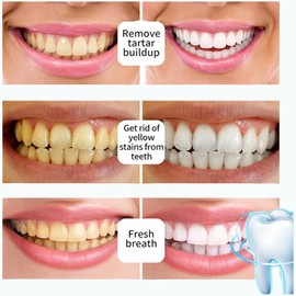 Purely White Deluxe Tooth Brightening Powder, Nano Hydroxyapatite Whitening Blend, Gentle Smiles Dental Care Dust, Microcrystalline Hydroxyapatite Infusion, Pearl Extract for Oral Brightening (2pcs)