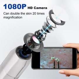 Kosimai Black Head Remover for Face Tool Professional Pimple Popper HD Camera,30 Times Magnification 1080P, (25)